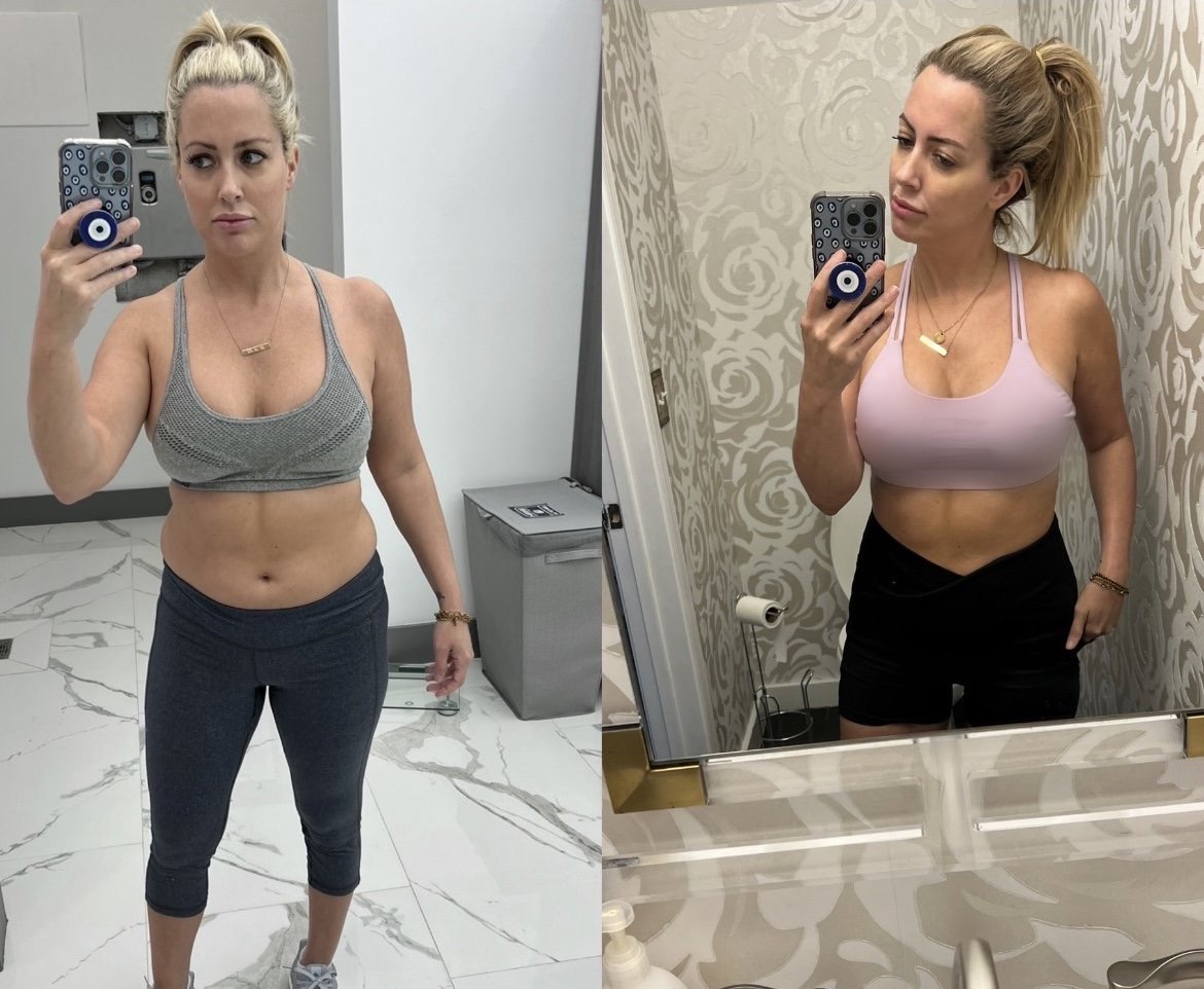 Brigid Barrett, founder of The Peptide Fairy, before and after